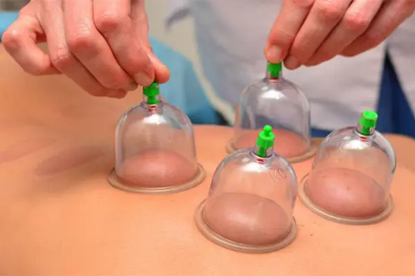 الحجامة المتحركة