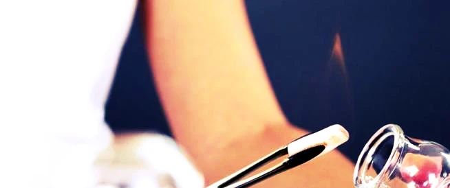 أنواع الحجامة المختلفة