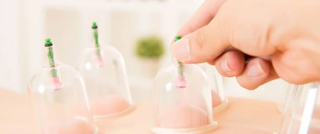 فوائد الحجامة للنساء