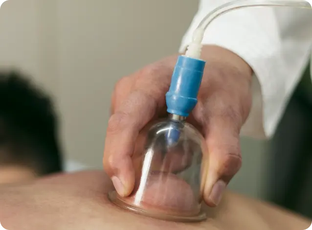 الحجامة الجافة