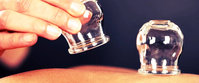 ما هي الحجامة؟